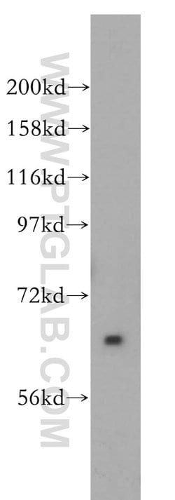 Pikachurin Rabbit anti-Human, Mouse, Rat, Polyclonal, Proteintech 150 &mu;L;