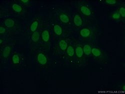 ERCC1 Rabbit anti-Human, Mouse, Rat, Polyclonal, Proteintech:Antibodies:Primary