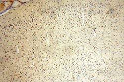 ERCC1 Rabbit anti-Human, Mouse, Rat, Polyclonal, Proteintech:Antibodies:Primary