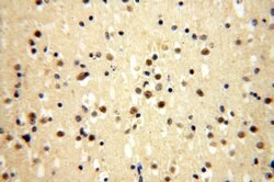 ERCC1 Rabbit anti-Human, Mouse, Rat, Polyclonal, Proteintech:Antibodies:Primary