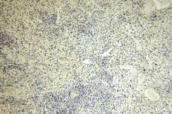 ERCC1 Rabbit anti-Human, Mouse, Rat, Polyclonal, Proteintech:Antibodies:Primary