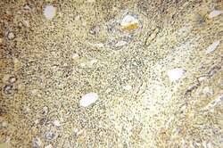ERCC1 Rabbit anti-Human, Mouse, Rat, Polyclonal, Proteintech:Antibodies:Primary
