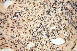 ERCC1 Rabbit anti-Human, Mouse, Rat, Polyclonal, Proteintech:Antibodies:Primary