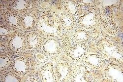 ERCC1 Rabbit anti-Human, Mouse, Rat, Polyclonal, Proteintech:Antibodies:Primary