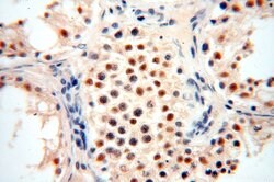 ERCC1 Rabbit anti-Human, Mouse, Rat, Polyclonal, Proteintech:Antibodies:Primary
