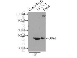 ERCC1 Rabbit anti-Human, Mouse, Rat, Polyclonal, Proteintech:Antibodies:Primary