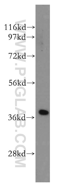 ERCC1 Rabbit anti-Human, Mouse, Rat, Polyclonal, Proteintech:Antibodies:Primary