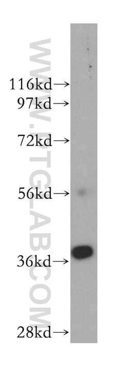ERCC1 Rabbit anti-Human, Mouse, Rat, Polyclonal, Proteintech:Antibodies:Primary