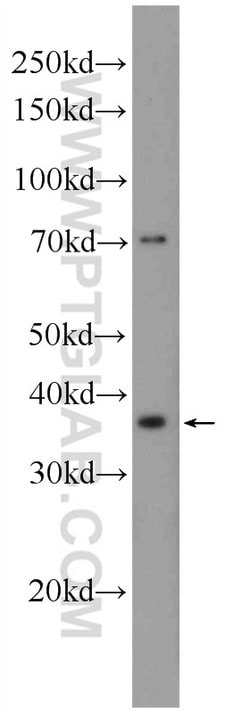 ERCC1 Rabbit anti-Human, Mouse, Rat, Polyclonal, Proteintech:Antibodies:Primary