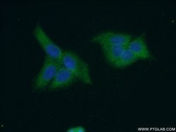 CES3 Rabbit anti-Human, Mouse, Polyclonal, Proteintech:Antibodies:Primary