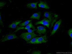Integrin alpha-9 Rabbit anti-Human, Mouse, Rat, Polyclonal, Proteintech