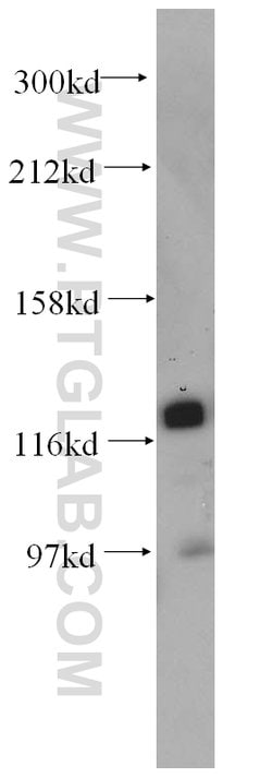 HNRNPU Rabbit anti-Human, Mouse, Rat, Polyclonal, Proteintech 150 &mu;L;