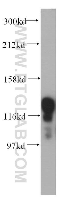 HNRNPU Rabbit anti-Human, Mouse, Rat, Polyclonal, Proteintech 150 &mu;L;