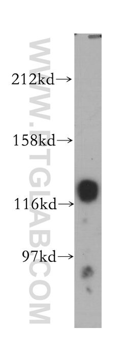 HNRNPU Rabbit anti-Human, Mouse, Rat, Polyclonal, Proteintech 150 &mu;L;