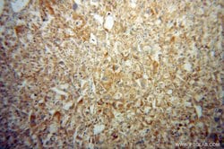 HIBCH Rabbit anti-Human, Mouse, Rat, Polyclonal, Proteintech 150 &mu;L;