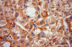 HIBCH Rabbit anti-Human, Mouse, Rat, Polyclonal, Proteintech 150 &mu;L;