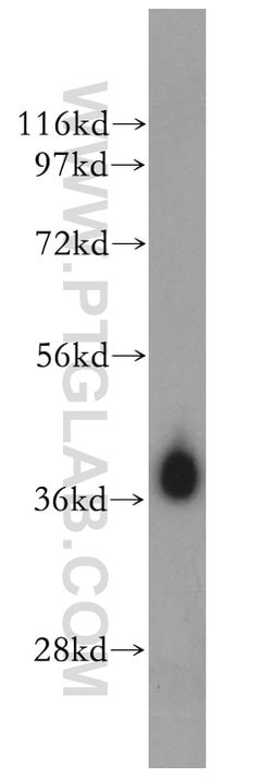 HIBCH Rabbit anti-Human, Mouse, Rat, Polyclonal, Proteintech 150 &mu;L;
