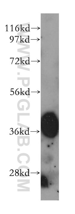 HIBCH Rabbit anti-Human, Mouse, Rat, Polyclonal, Proteintech 150 &mu;L;