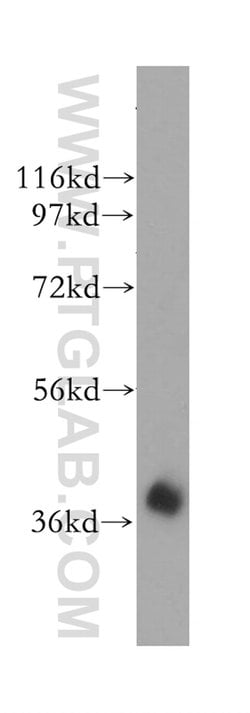 HIBCH Rabbit anti-Human, Mouse, Rat, Polyclonal, Proteintech 150 &mu;L;