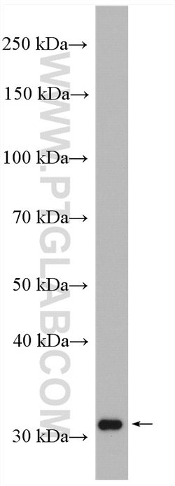 MEMO1 Rabbit anti-Human, Mouse, Rat, Polyclonal, Proteintech 150 &mu;L;
