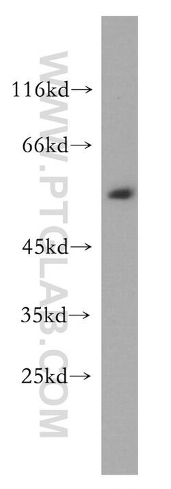MEMO1 Rabbit anti-Human, Mouse, Rat, Polyclonal, Proteintech 150 &mu;L;