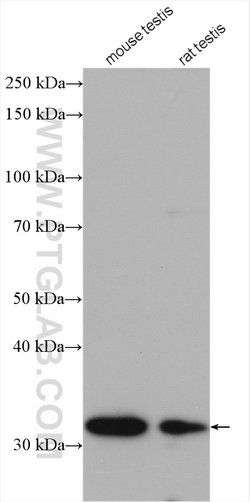 MEMO1 Rabbit anti-Human, Mouse, Rat, Polyclonal, Proteintech 150 &mu;L;