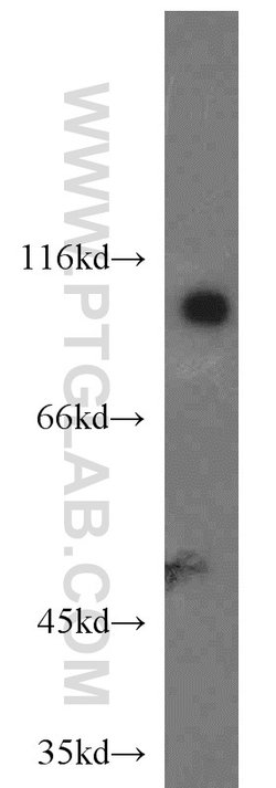 DNM2 Rabbit anti-Human, Mouse, Rat, Polyclonal, Proteintech 150 &mu;L;