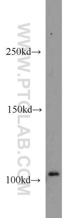 DNM2 Rabbit anti-Human, Mouse, Rat, Polyclonal, Proteintech 150 &mu;L;
