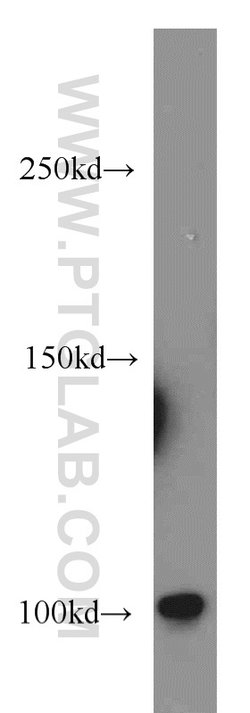 DNM2 Rabbit anti-Human, Mouse, Rat, Polyclonal, Proteintech 150 &mu;L;