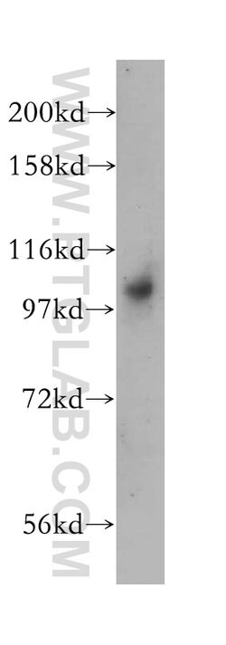 DNM2 Rabbit anti-Human, Mouse, Rat, Polyclonal, Proteintech 150 &mu;L;