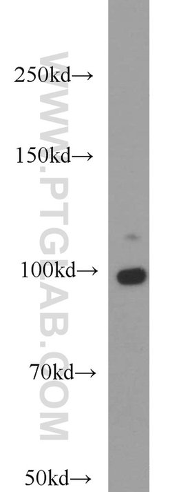 DNM2 Rabbit anti-Human, Mouse, Rat, Polyclonal, Proteintech 150 &mu;L;
