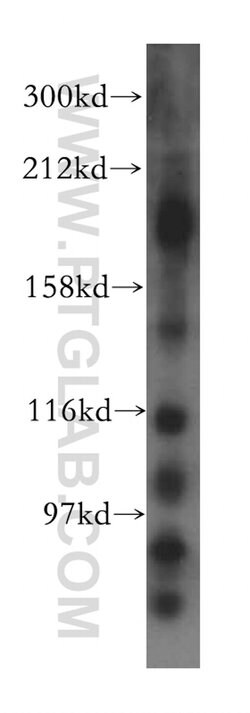 Proteintech KIF17 Rabbit anti-Human, Mouse, Non-human primate, Rat, Polyclonal, Proteintech