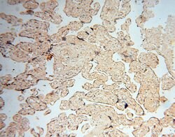 AKAP14 Rabbit anti-Human, Polyclonal, Proteintech:Antibodies:Primary Antibodies