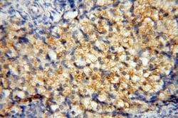 AKAP14 Rabbit anti-Human, Polyclonal, Proteintech:Antibodies:Primary Antibodies