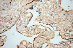 AKAP14 Rabbit anti-Human, Polyclonal, Proteintech:Antibodies:Primary Antibodies