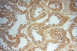 AKAP14 Rabbit anti-Human, Polyclonal, Proteintech:Antibodies:Primary Antibodies