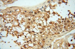AKAP14 Rabbit anti-Human, Polyclonal, Proteintech:Antibodies:Primary Antibodies