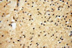 AKAP14 Rabbit anti-Human, Polyclonal, Proteintech:Antibodies:Primary Antibodies