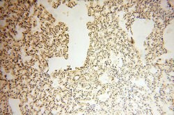 AKAP14 Rabbit anti-Human, Polyclonal, Proteintech:Antibodies:Primary Antibodies