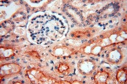 AKAP14 Rabbit anti-Human, Polyclonal, Proteintech:Antibodies:Primary Antibodies
