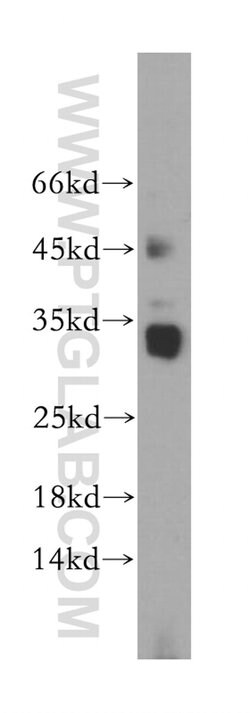 AKAP14 Rabbit anti-Human, Polyclonal, Proteintech:Antibodies:Primary Antibodies