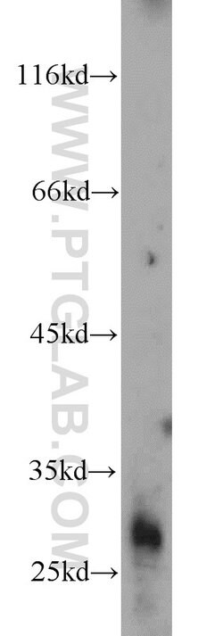 AKAP14 Rabbit anti-Human, Polyclonal, Proteintech:Antibodies:Primary Antibodies