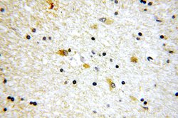 SV2B Rabbit anti-Human, Mouse, Rat, Polyclonal, Proteintech 150 &mu;L;