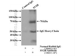 SV2B Rabbit anti-Human, Mouse, Rat, Polyclonal, Proteintech 150 &mu;L;