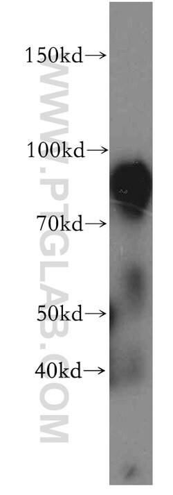 SV2B Rabbit anti-Human, Mouse, Rat, Polyclonal, Proteintech 150 &mu;L;