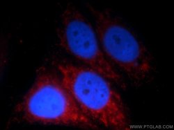 HPS4 Rabbit anti-Human, Polyclonal, Proteintech:Antibodies:Primary Antibodies