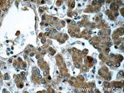 HPS4 Rabbit anti-Human, Polyclonal, Proteintech:Antibodies:Primary Antibodies