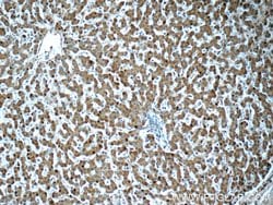 HPS4 Rabbit anti-Human, Polyclonal, Proteintech:Antibodies:Primary Antibodies