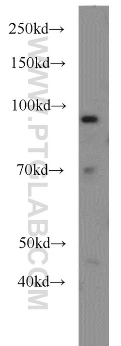 HPS4 Rabbit anti-Human, Polyclonal, Proteintech:Antibodies:Primary Antibodies