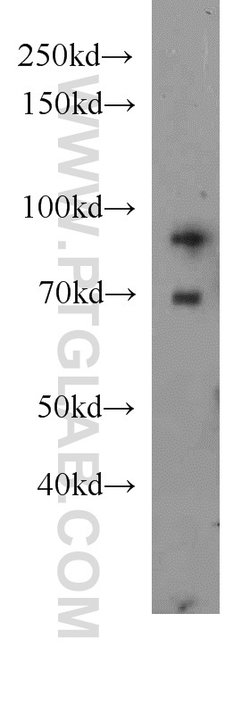 HPS4 Rabbit anti-Human, Polyclonal, Proteintech:Antibodies:Primary Antibodies